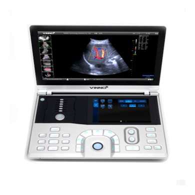vinno brand Sonography model VINNO V5
